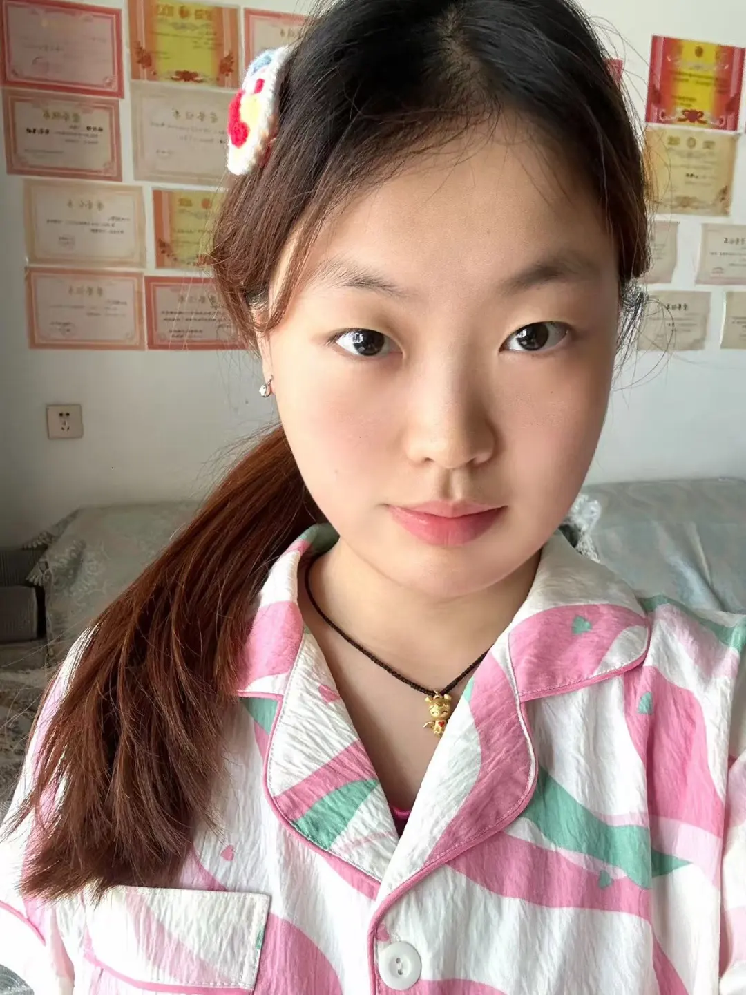 （新附对比）悄咪咪去做了人生第一次瘦脸针