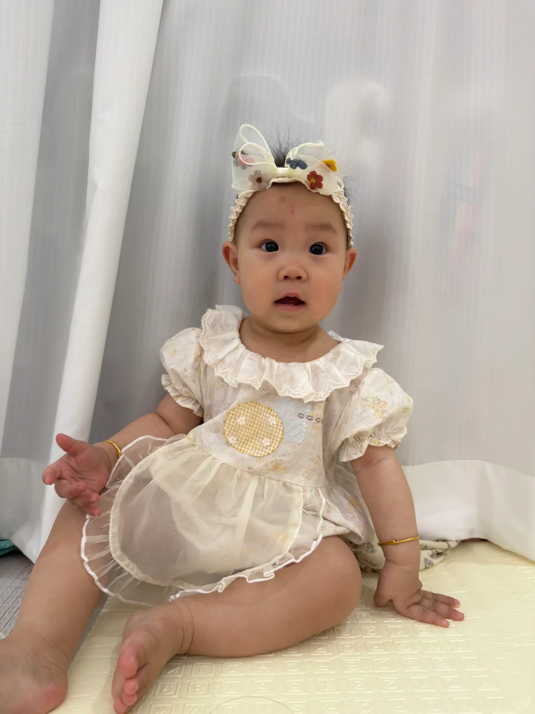 没有头发的一岁小女宝也能穿上漂亮的小裙子