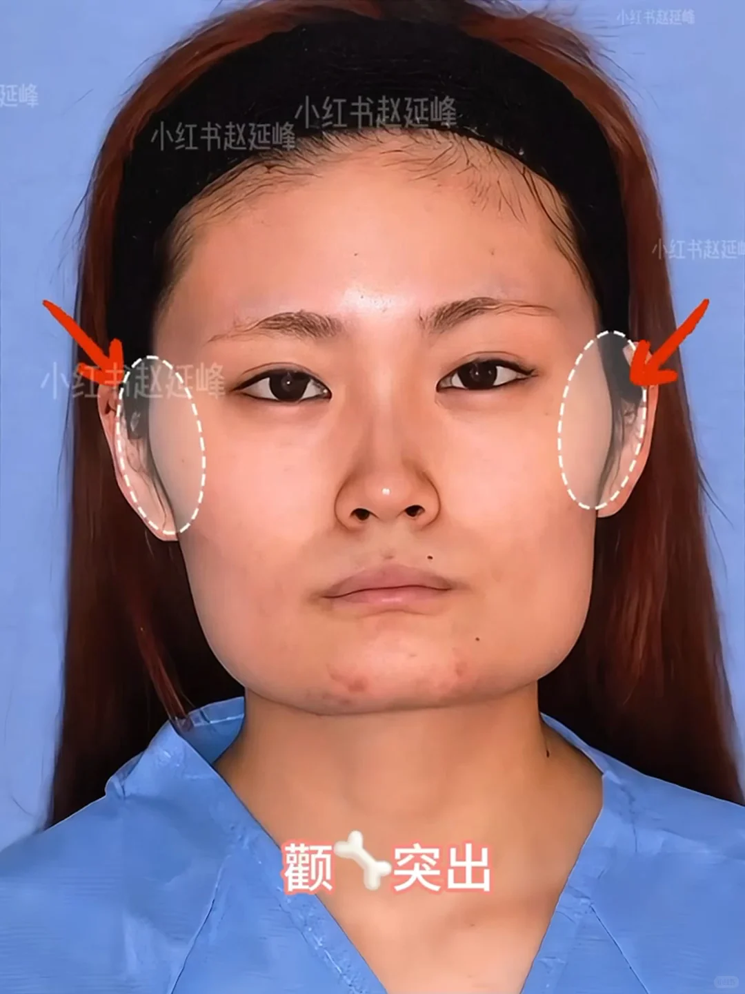 知道脸型重要，但没想到这么重要…