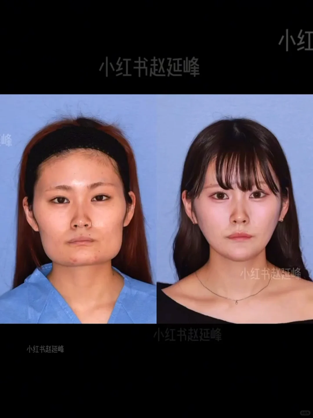 知道脸型重要，但没想到这么重要…