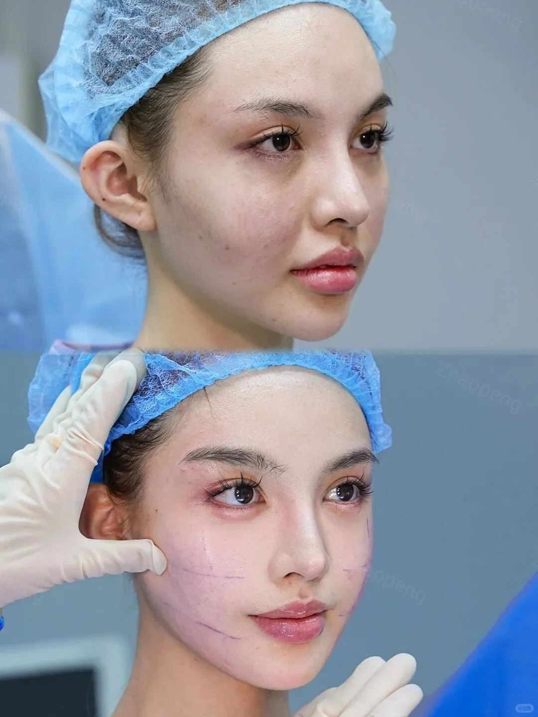 最具备性价比方案