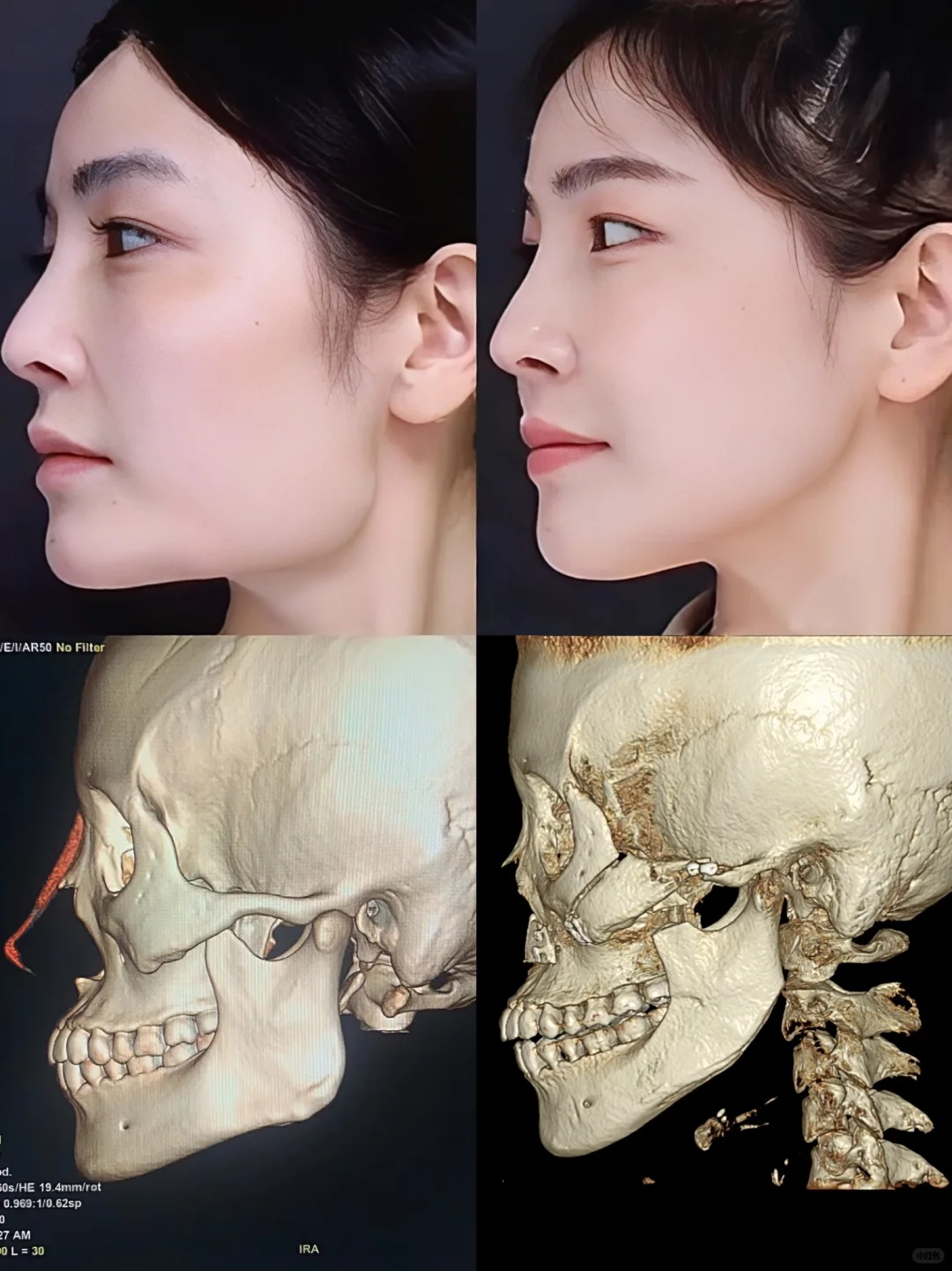 绝绝子！永远想不到一个丑女会有多努力