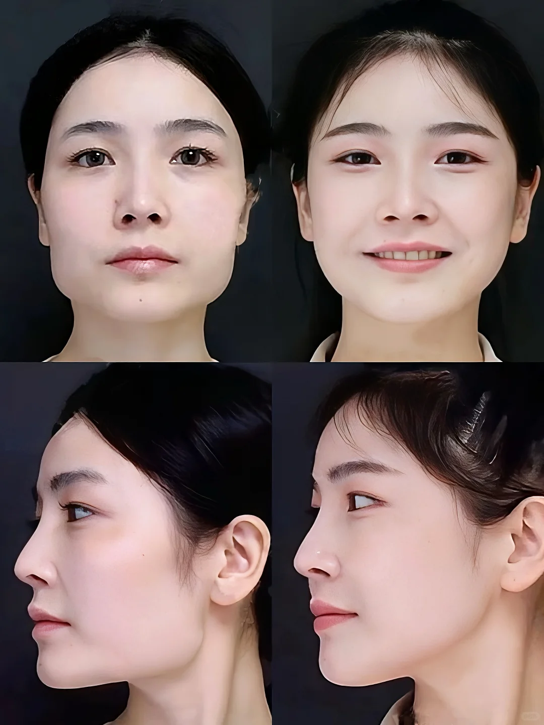 绝绝子！永远想不到一个丑女会有多努力