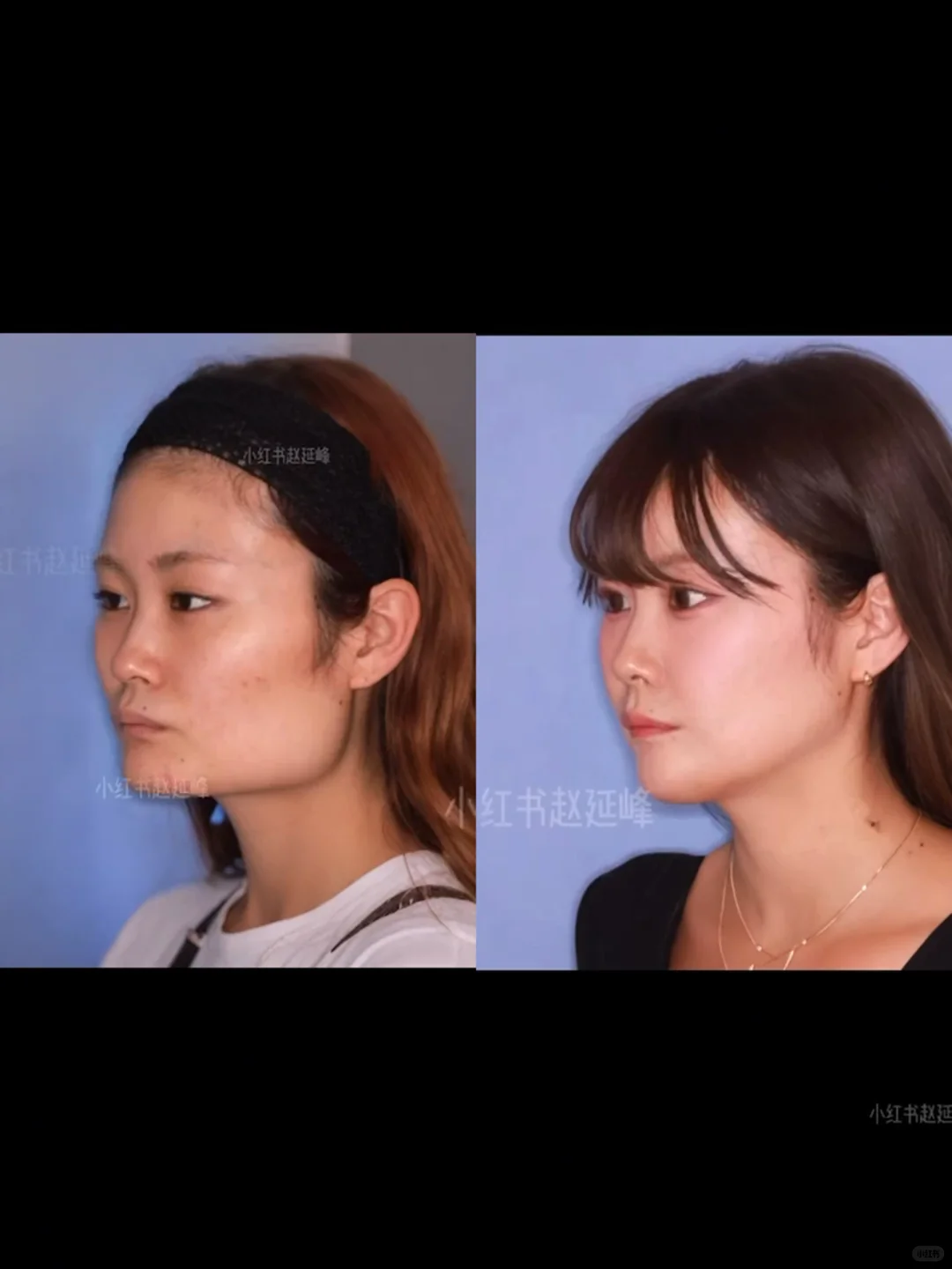 知道脸型重要，但没想到这么重要…