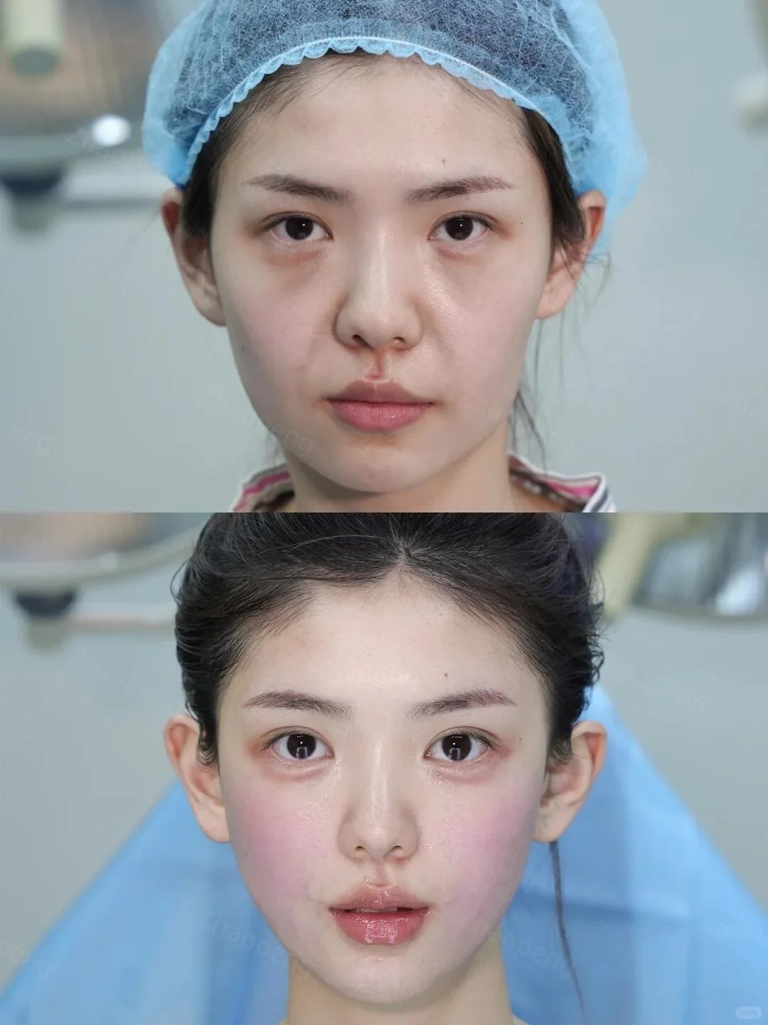 最具备性价比方案