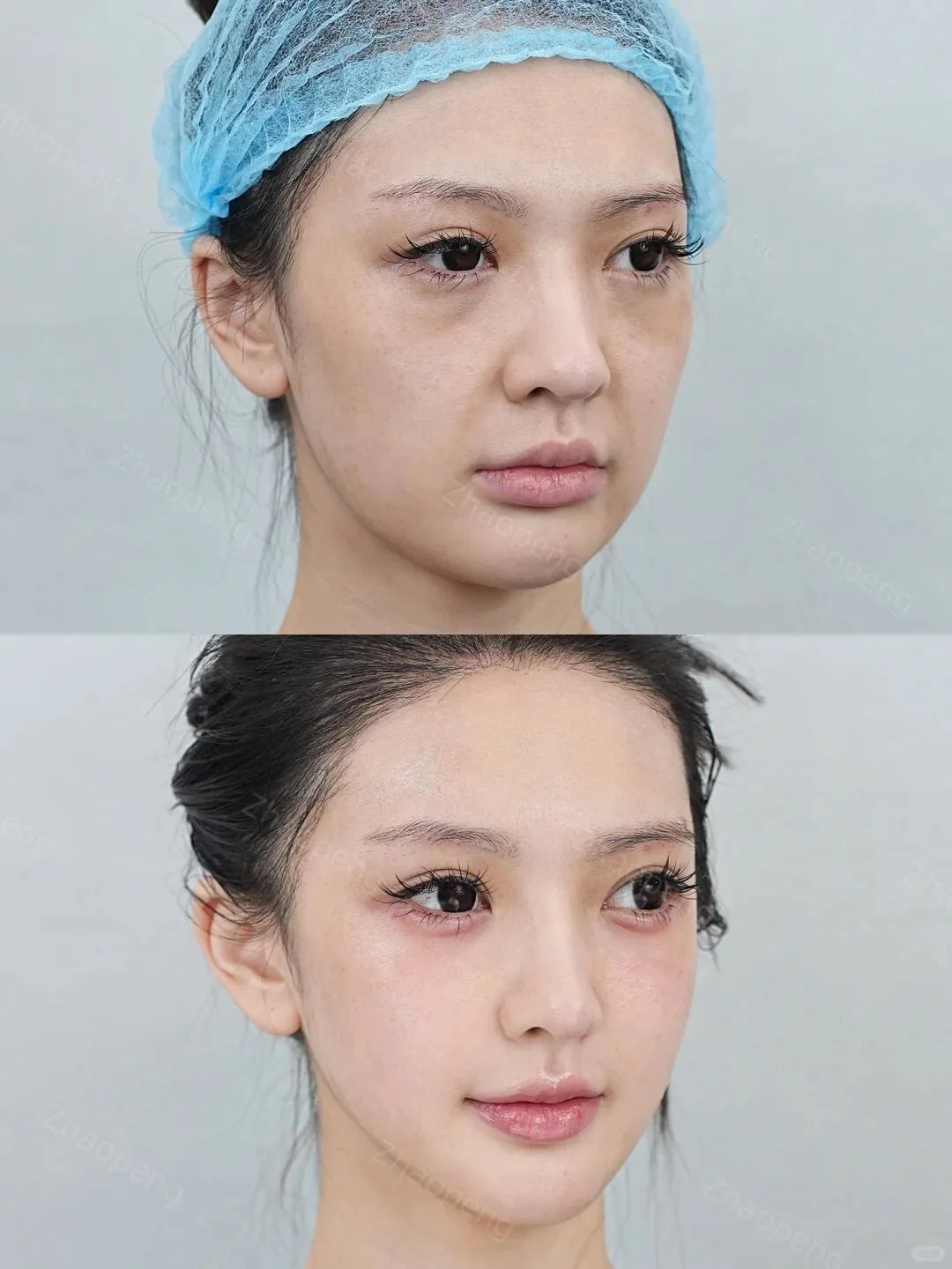 最具备性价比方案