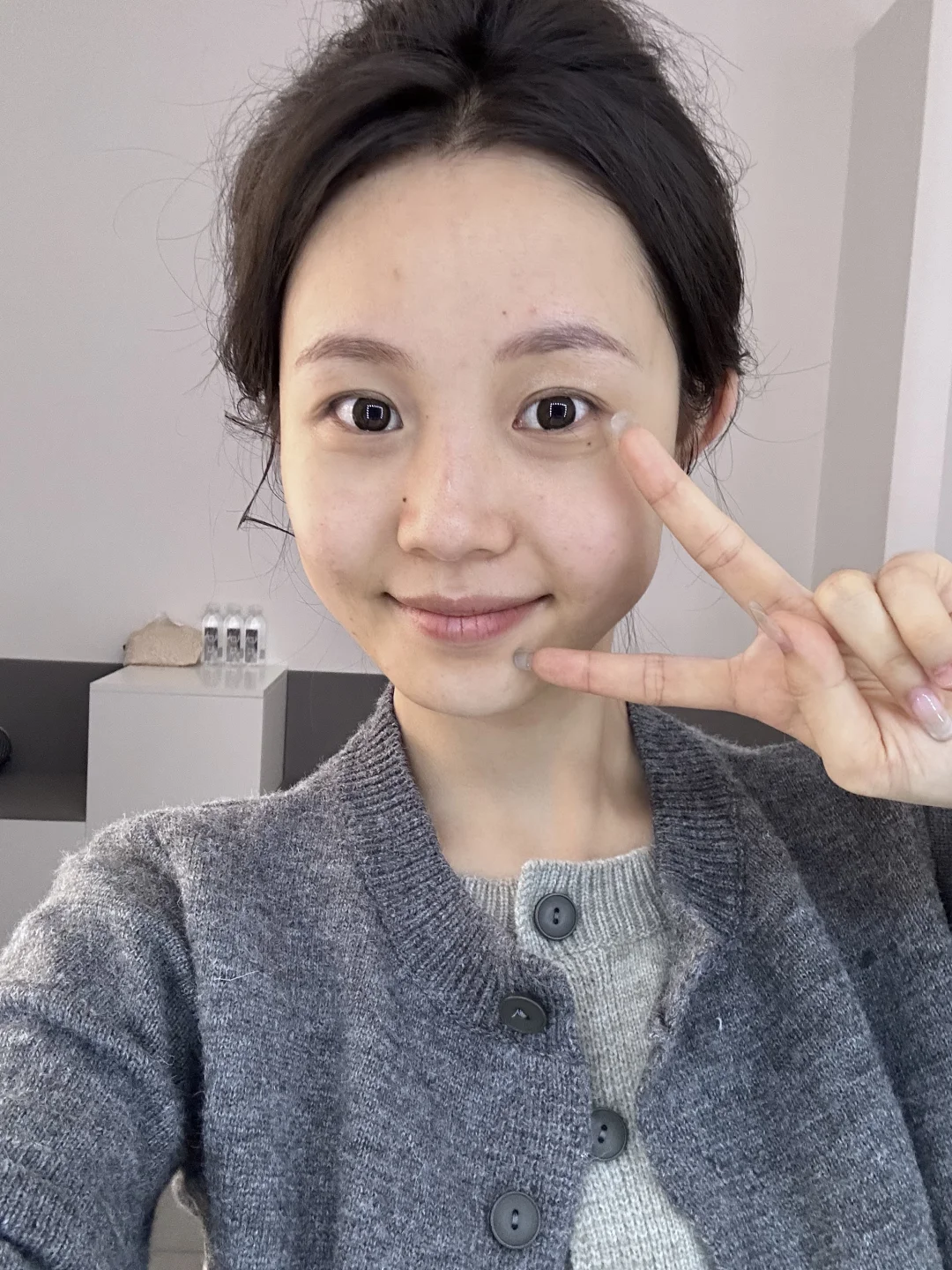 斑斑点点又如何？