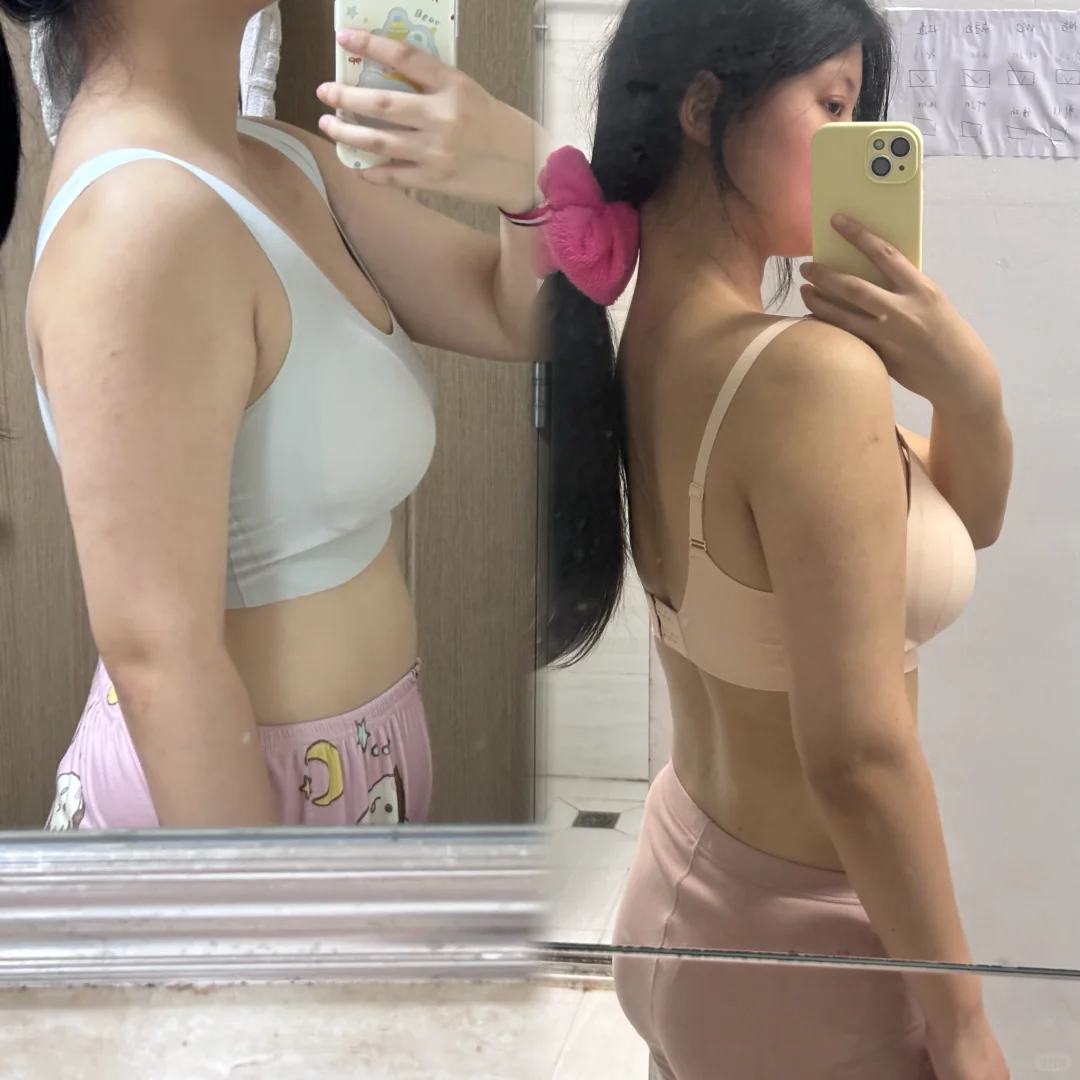 小基数瘦20斤的面部变化（含经验分享