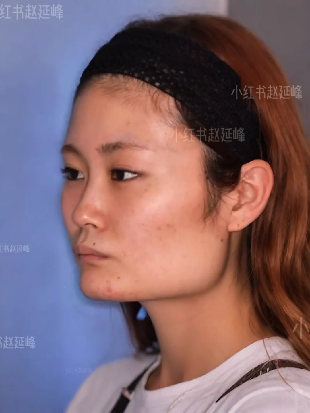 知道脸型重要，但没想到这么重要…