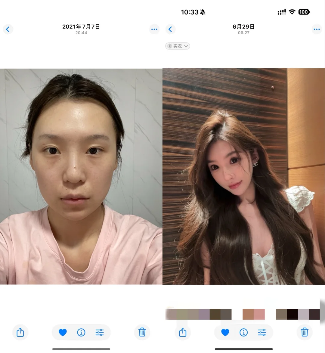 四年花费50w do脸前后对比