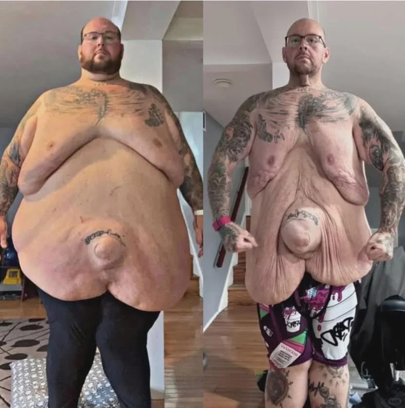 他用松弛的皮肤写下永不停止的逆袭史！