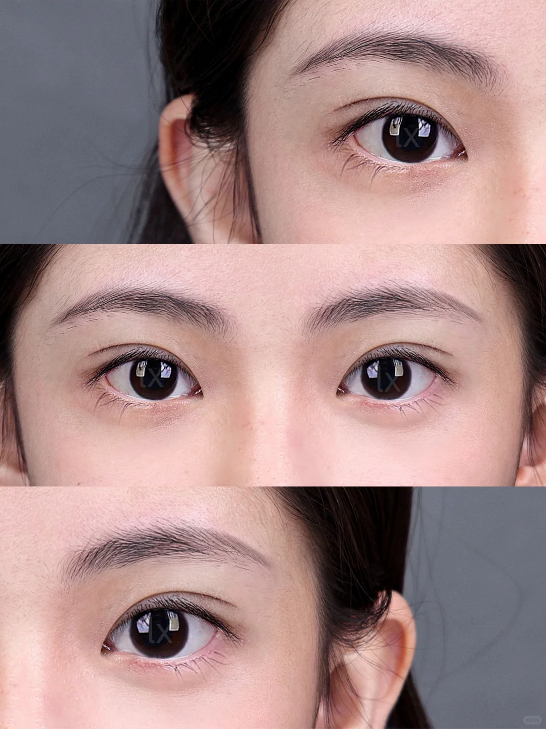 深圳双眼皮｜7mm开扇眼尾上扬纯欲眼～