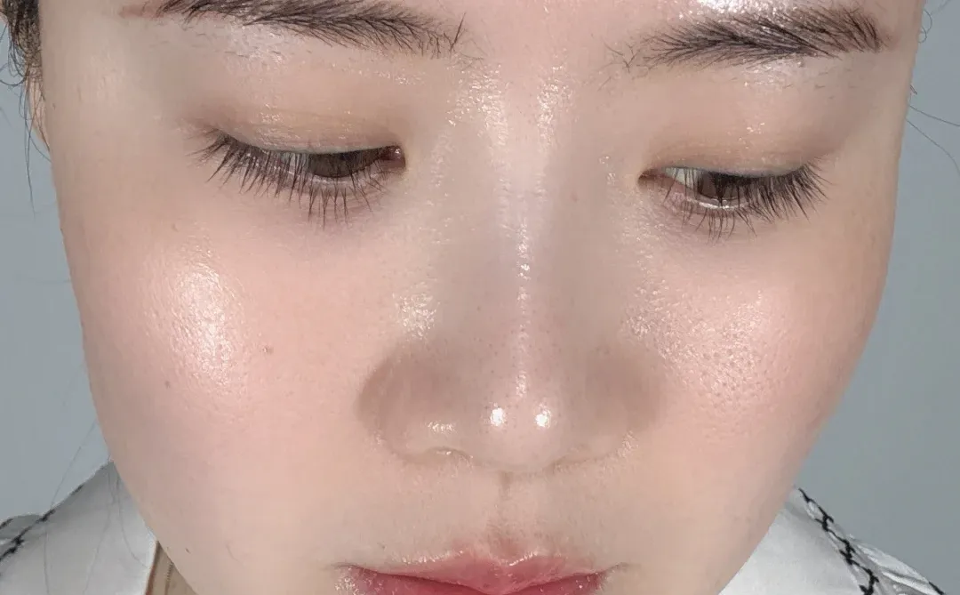 好皮肤就要怼脸拍🔥