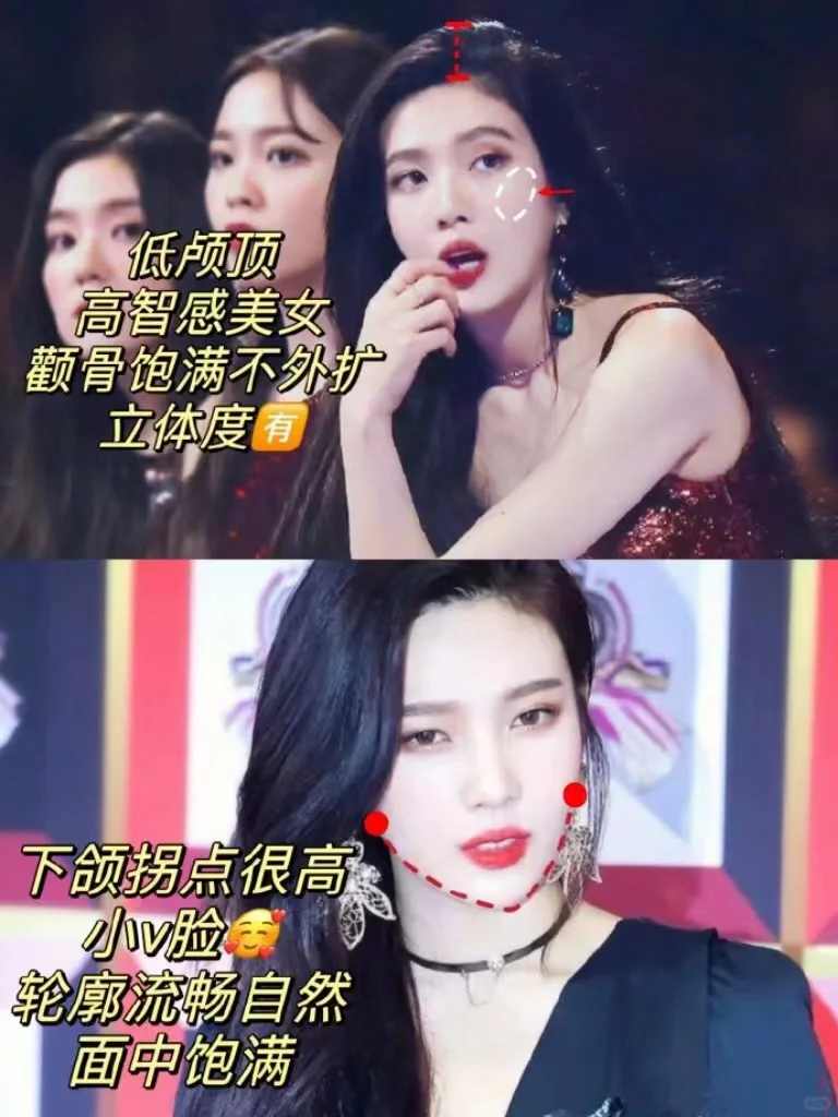 “肉肉脸+方圆脸”可参考韩女变美模板