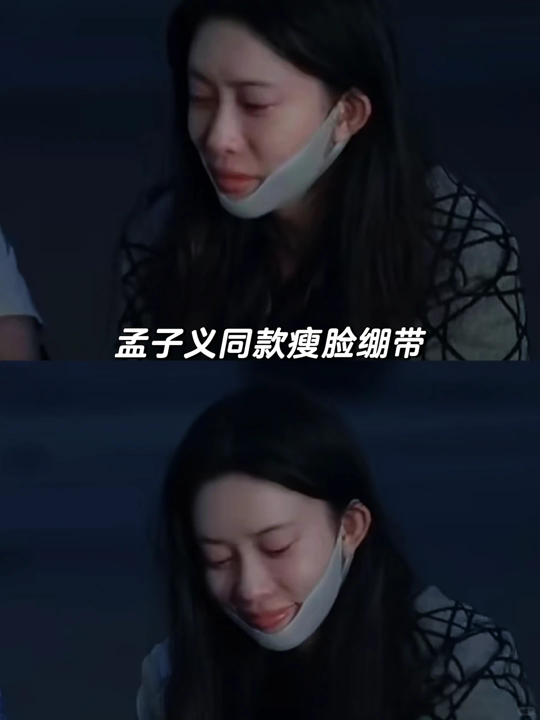 13.9Get明星同款小V脸‼️