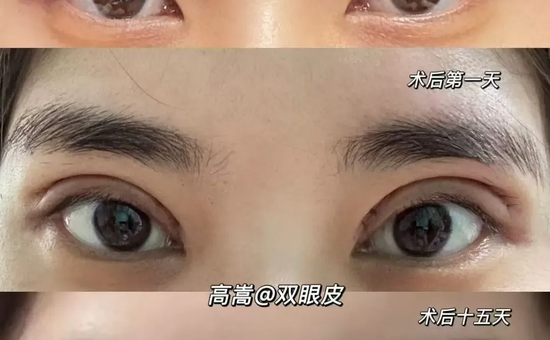 双眼皮，眼尾上扬