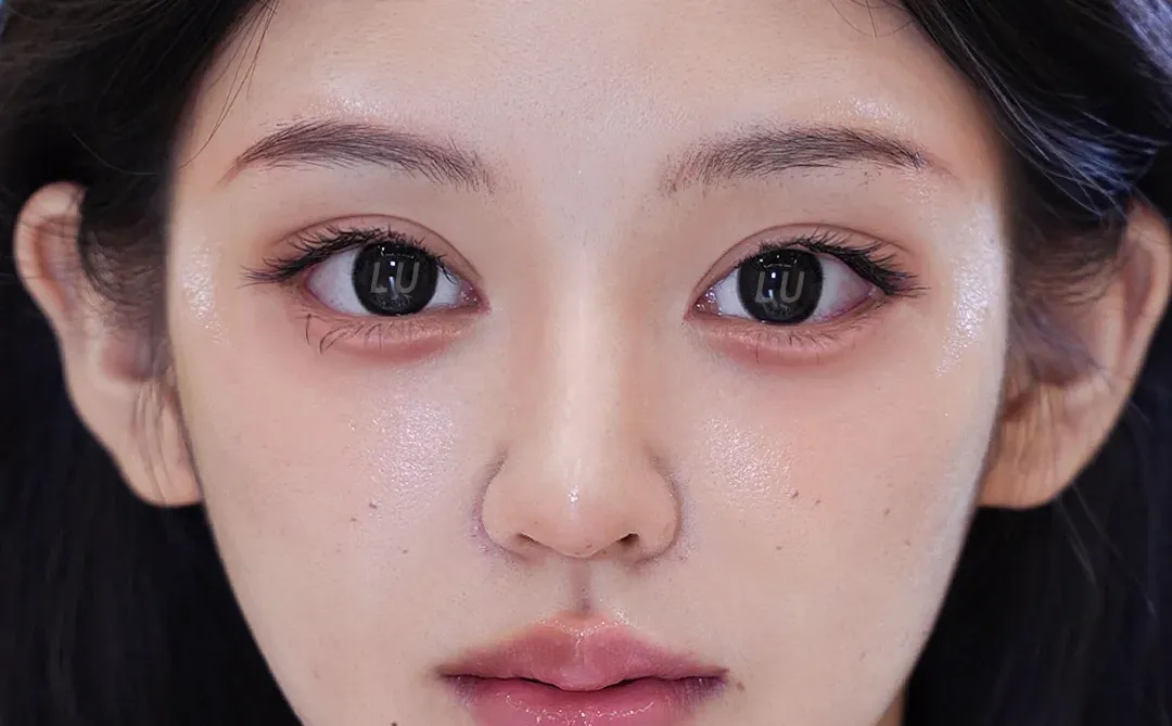 7mm修复，眼尾微扬，魅惑狐系眼拿捏