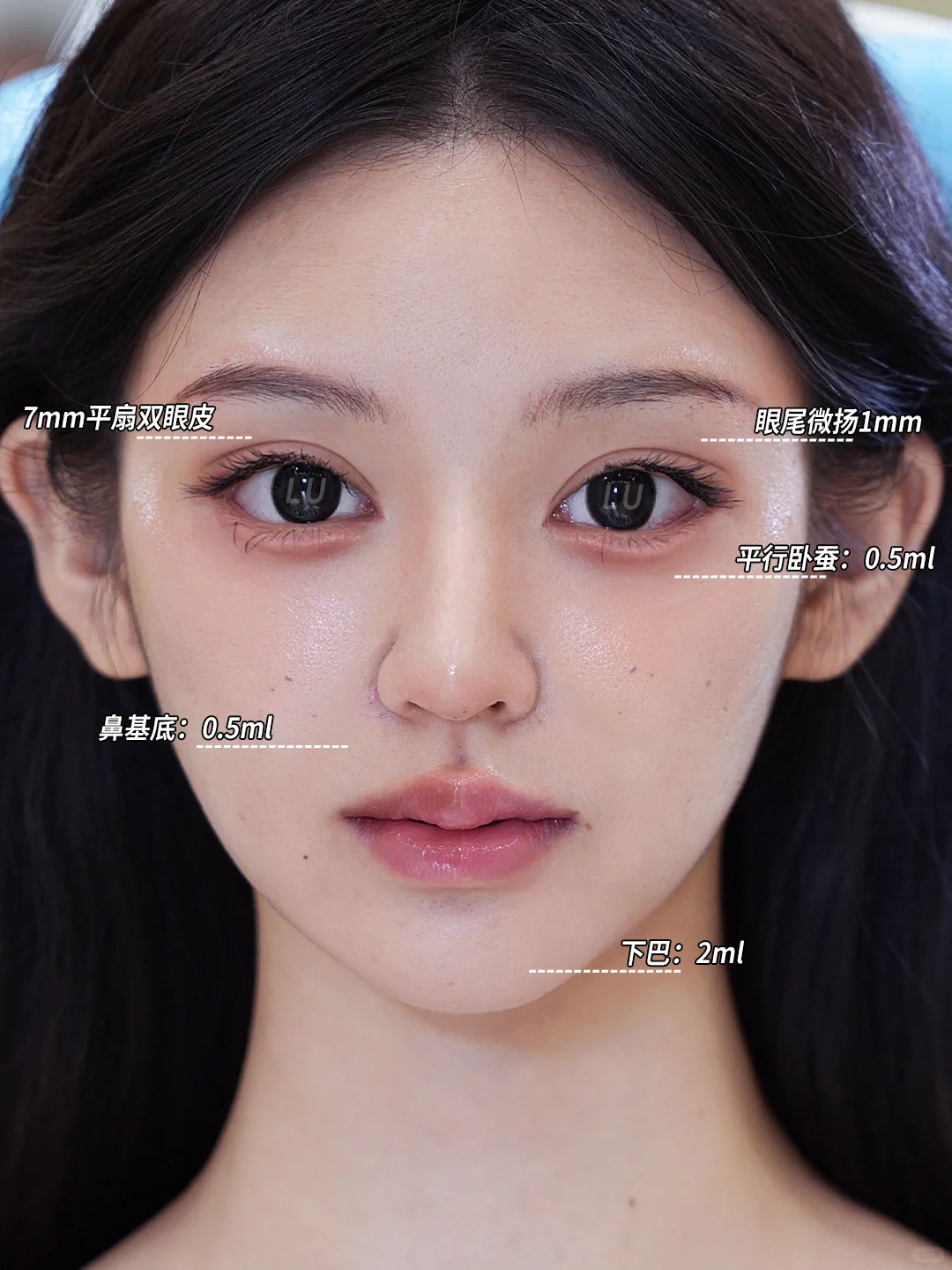 7mm修复，眼尾微扬，魅惑狐系眼拿捏