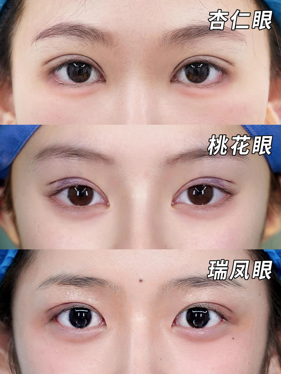 双眼皮模板来咯｜灵动自然一眼沦陷～