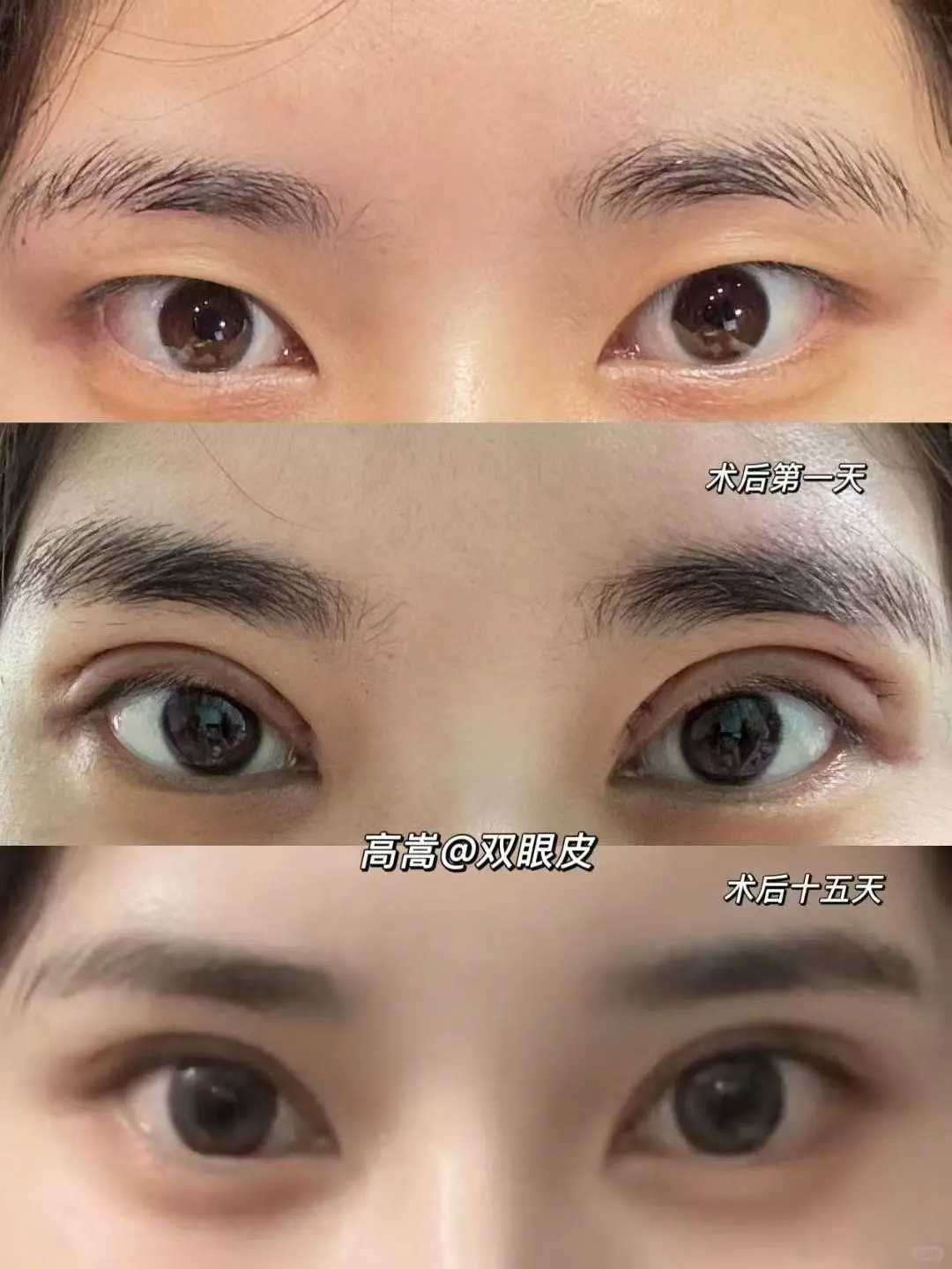双眼皮，眼尾上扬