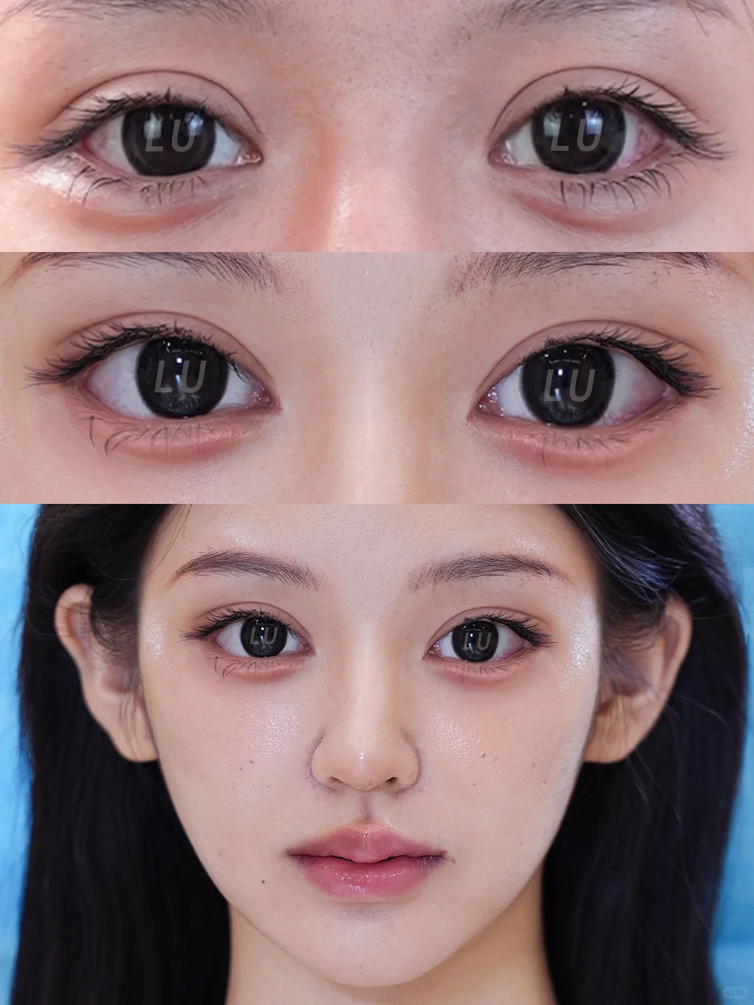 7mm修复，眼尾微扬，魅惑狐系眼拿捏