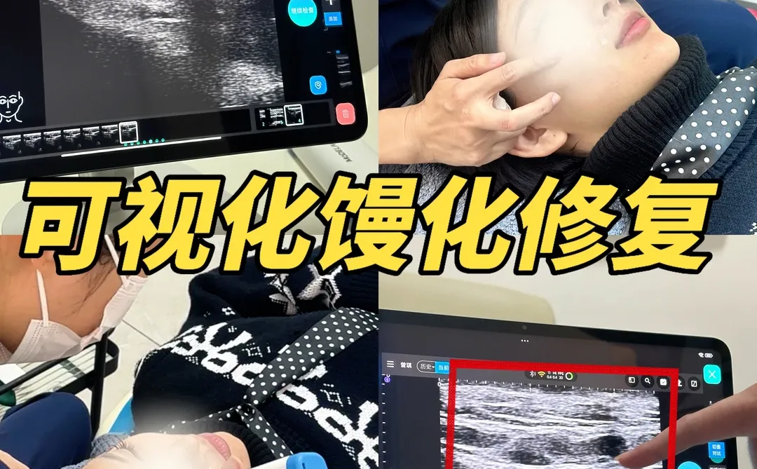 深圳去“馒”术｜发面馒头脸可视化改造