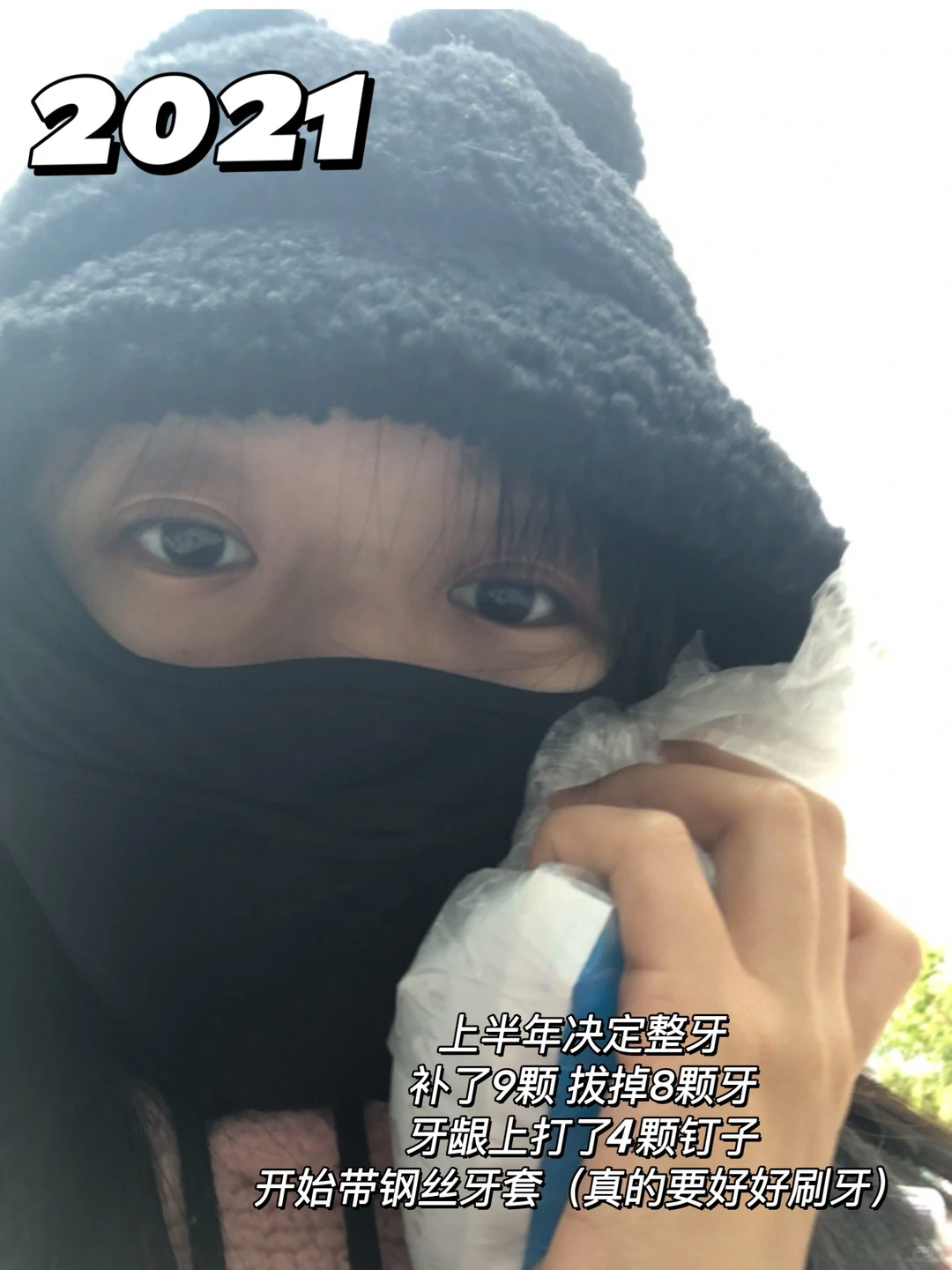 左滑看我十年变化‼️朋友都说完全认不出