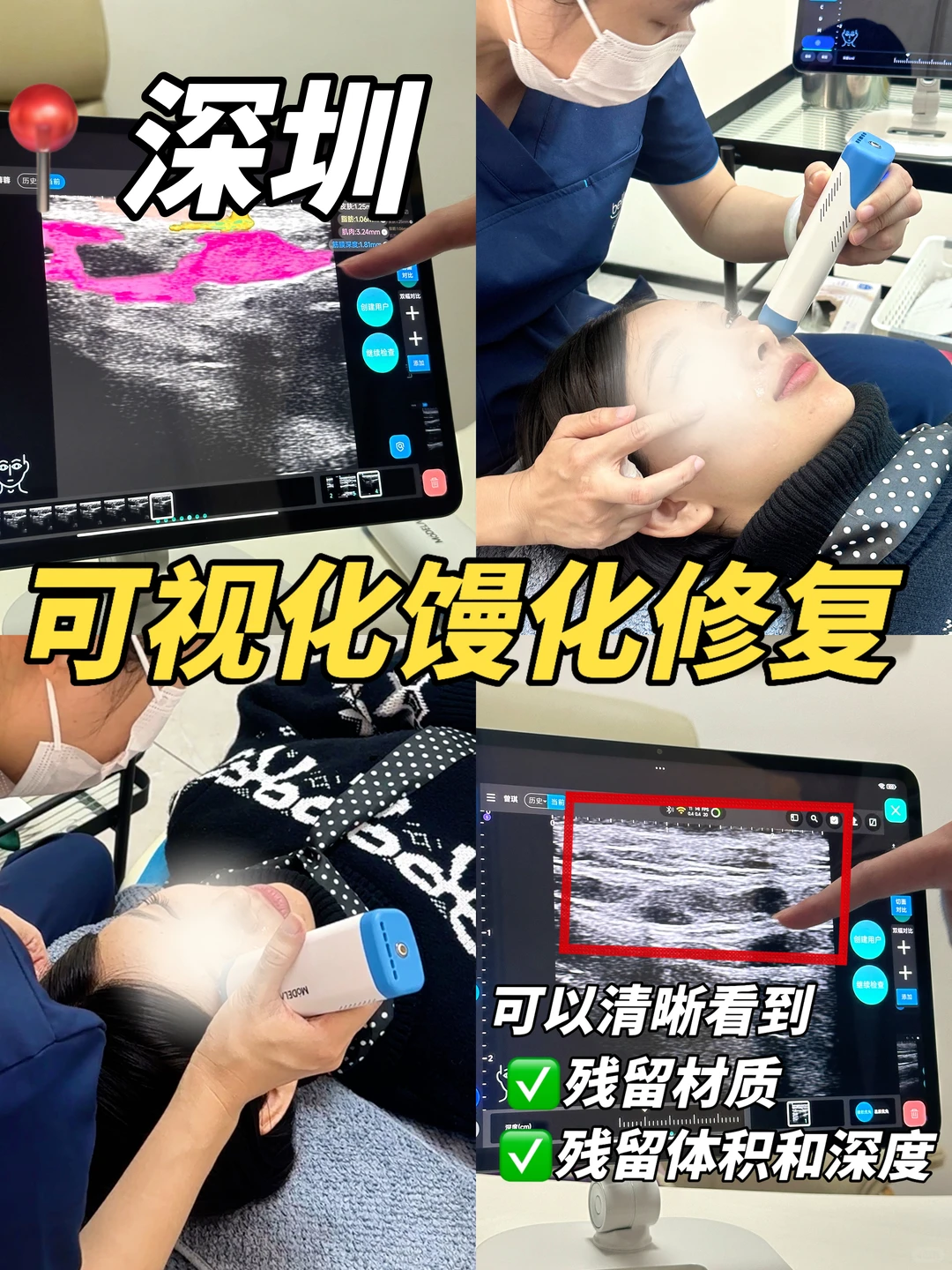 深圳去“馒”术｜发面馒头脸可视化改造