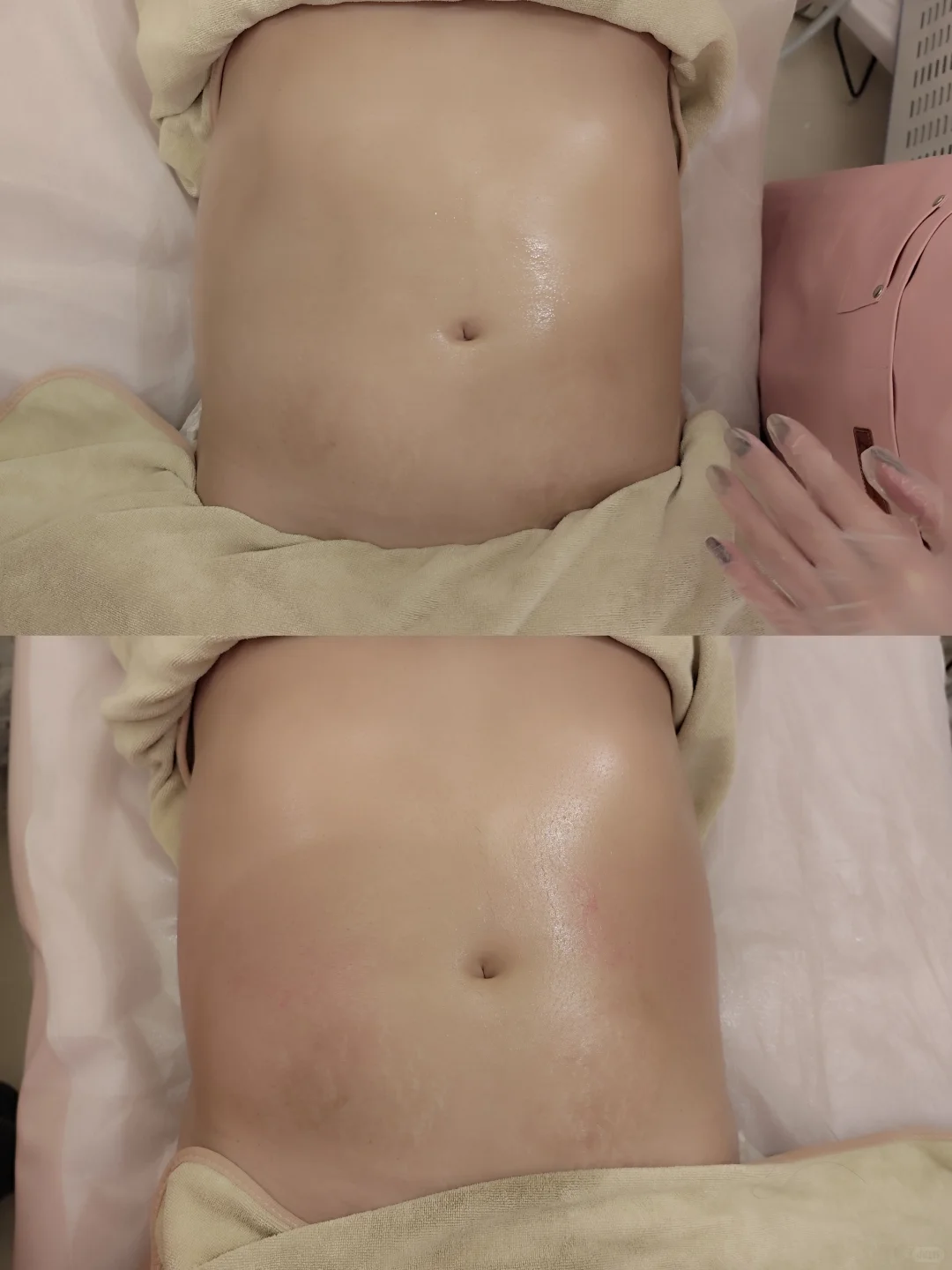 曲线部落不忌口减肥