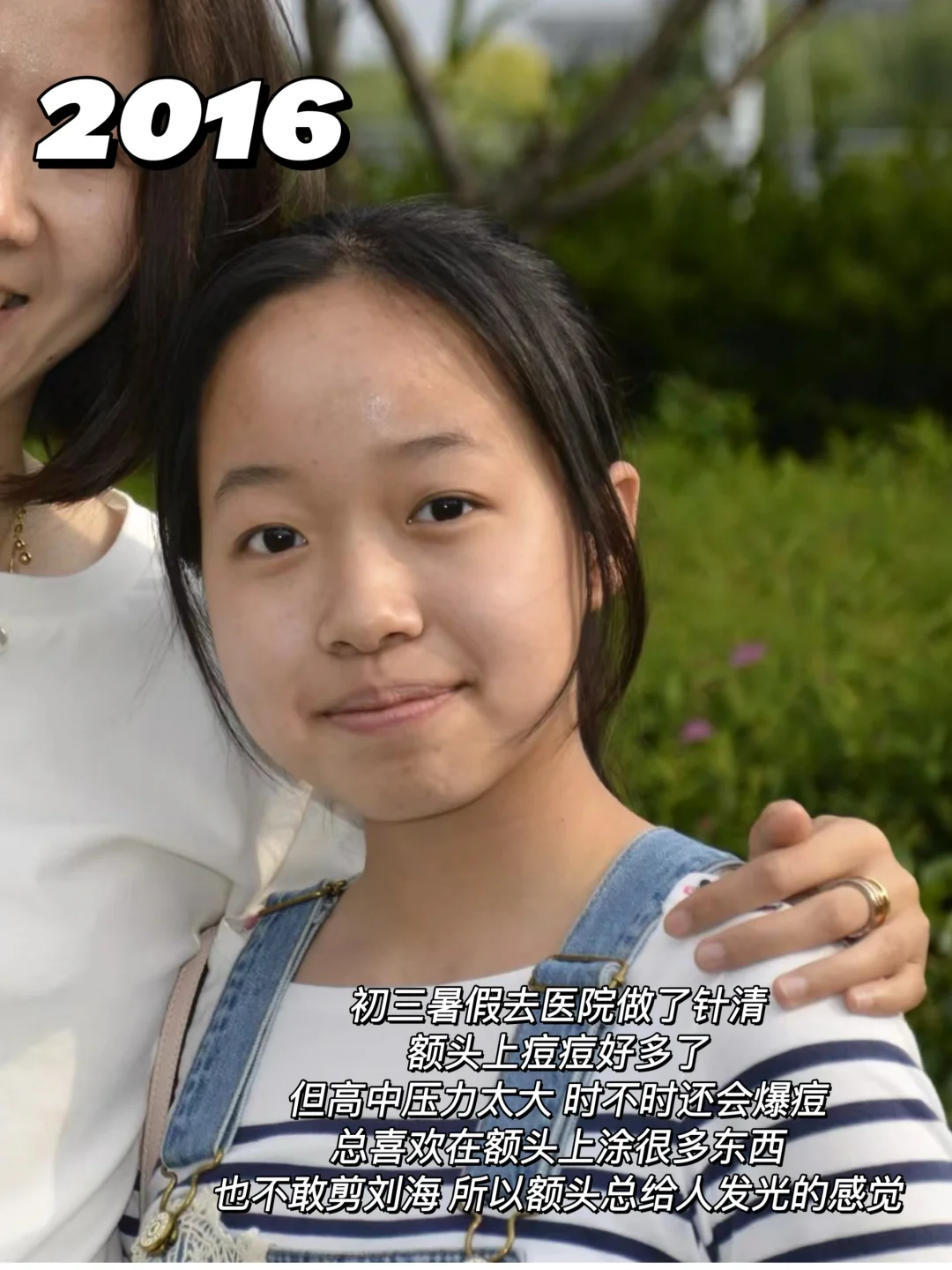 左滑看我十年变化‼️朋友都说完全认不出