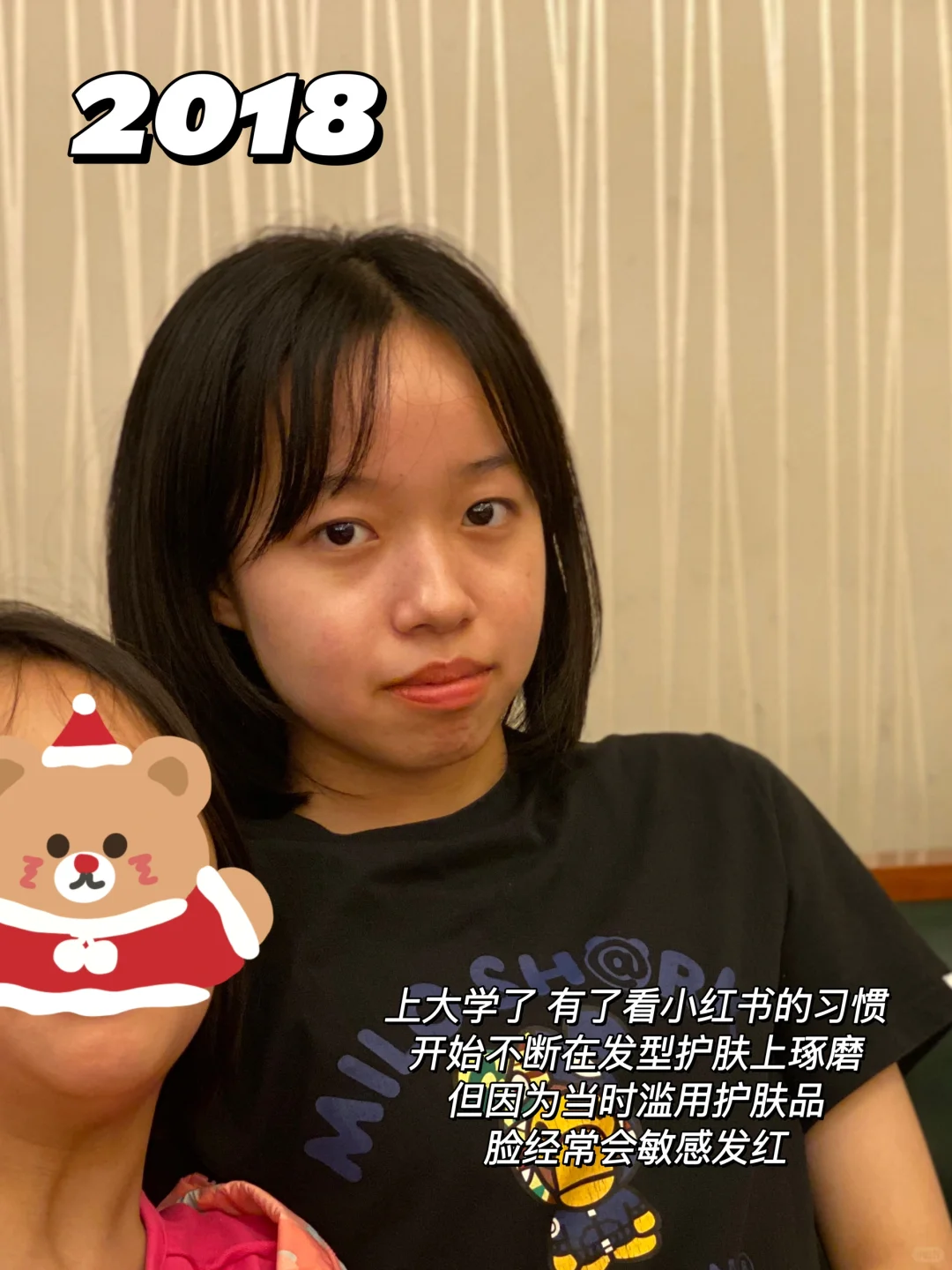 左滑看我十年变化‼️朋友都说完全认不出