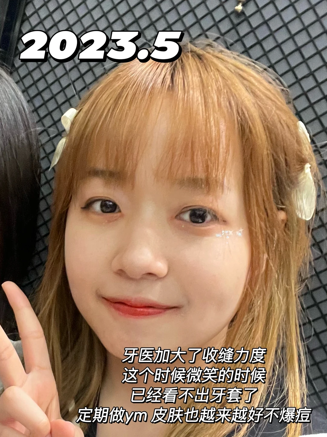 左滑看我十年变化‼️朋友都说完全认不出