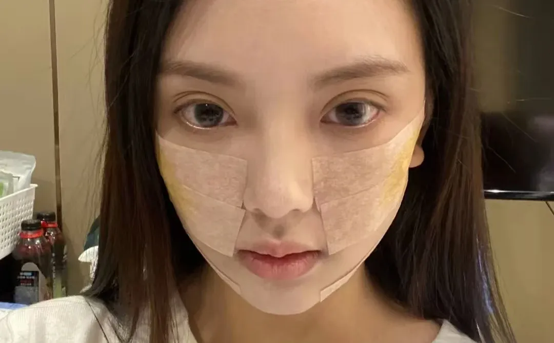 脸小了人都轻松多了