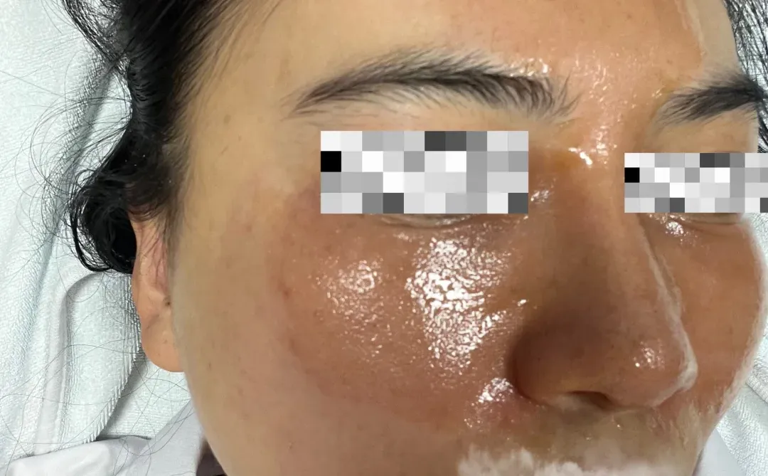 点阵完的脸 主打一个“先丑后美”