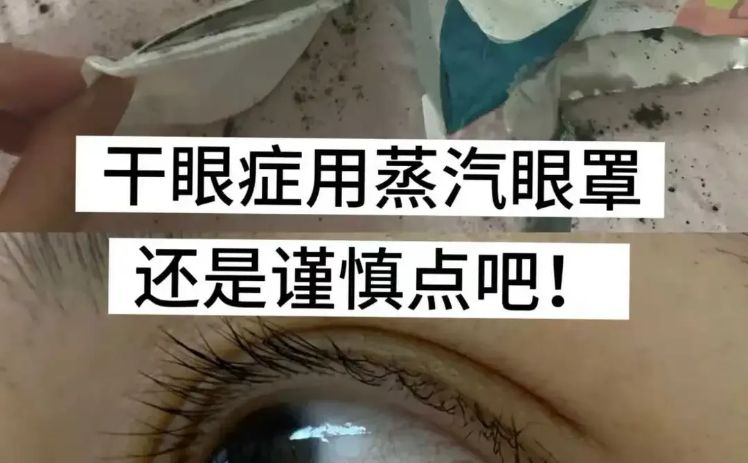 干眼症用蒸汽眼罩，还是谨慎点吧！！