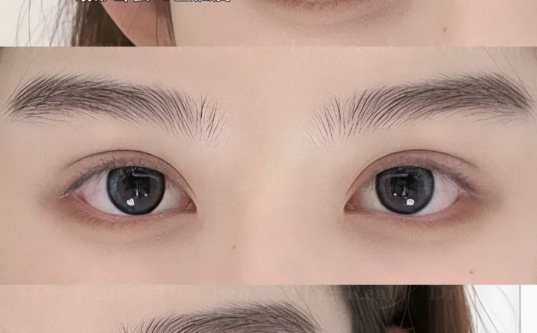 素颜天菜｜6.8mm幼系双眼皮模版