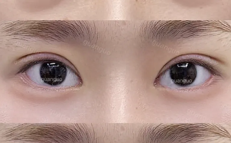 灵动小鹿眼 开扇➕卧蚕好幼呀