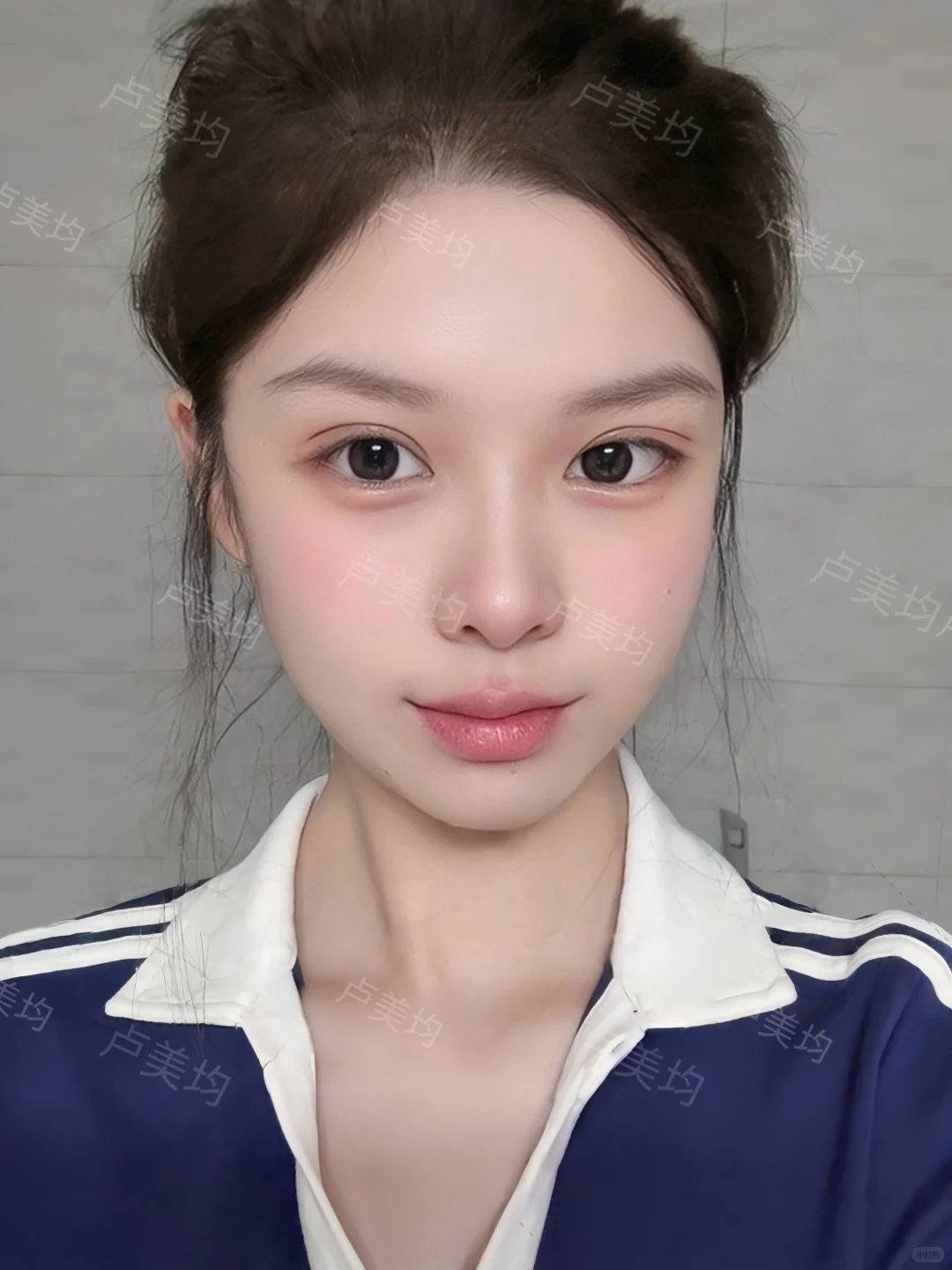 重庆双眼皮｜7mm开扇眼尾上扬纯欲眼～