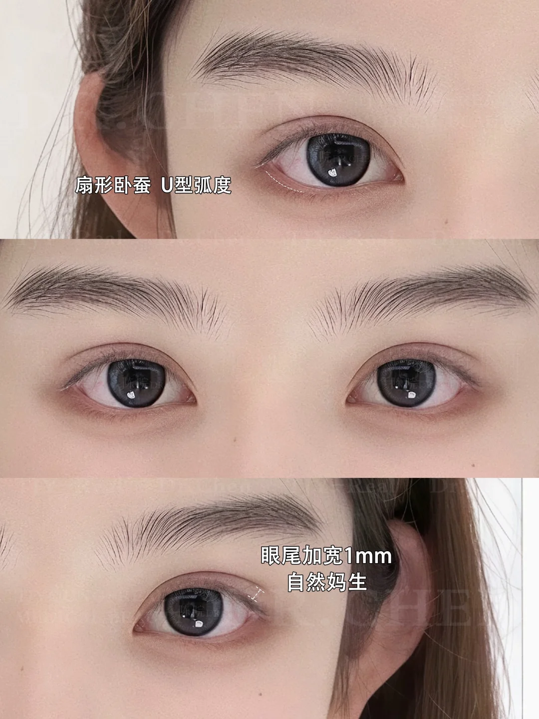 素颜天菜｜6.8mm幼系双眼皮模版