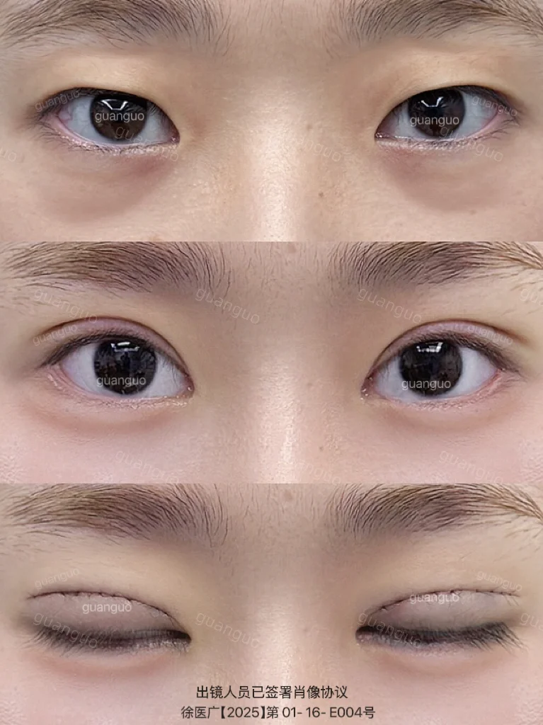 灵动小鹿眼 开扇➕卧蚕好幼呀