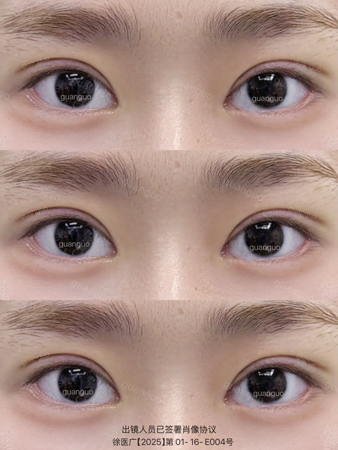 灵动小鹿眼 开扇➕卧蚕好幼呀