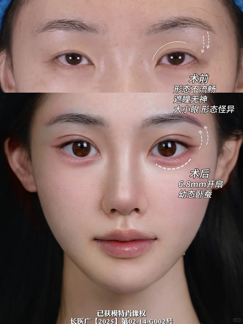 上海6.8mm双眼皮！清冷感拿捏～