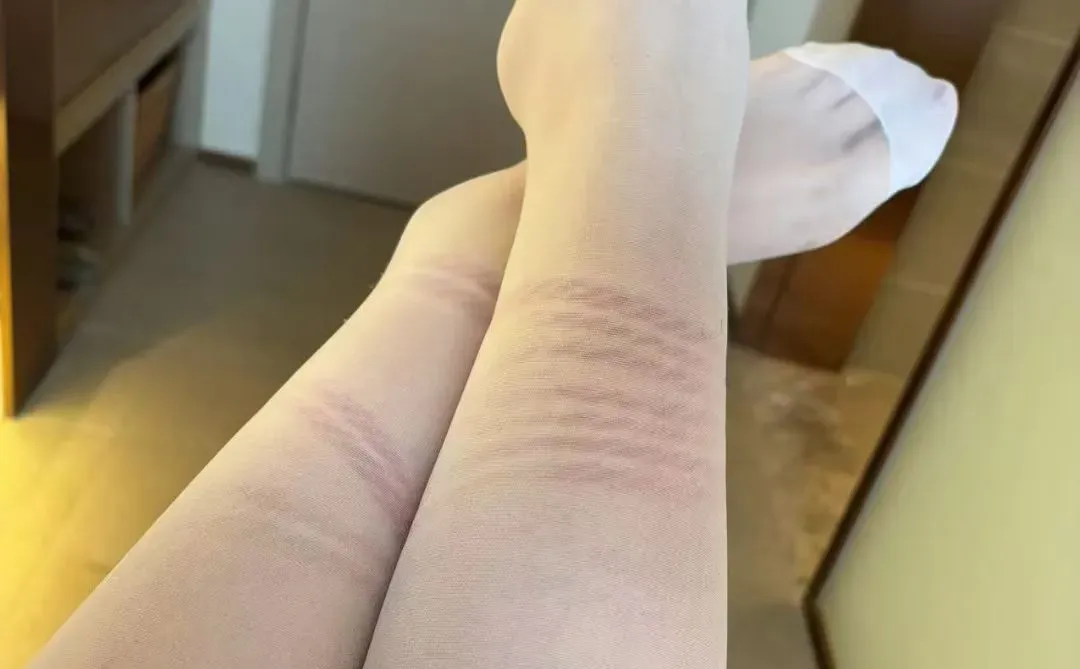 这一个有痕迹的腿腿