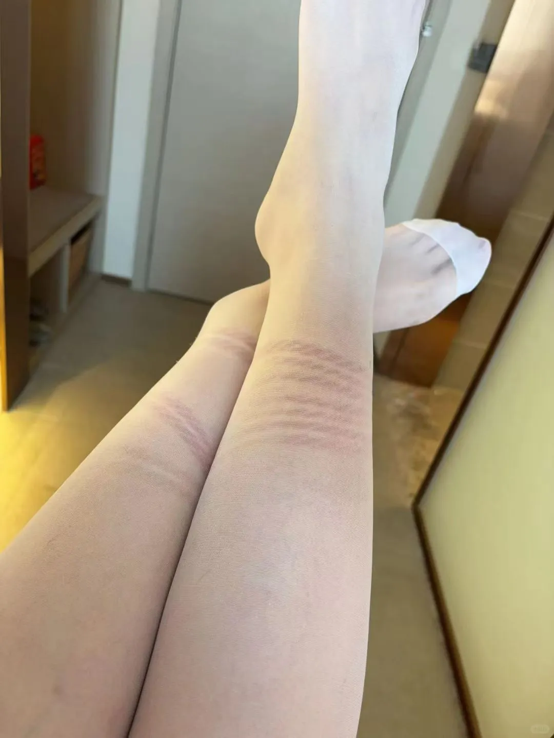 这一个有痕迹的腿腿