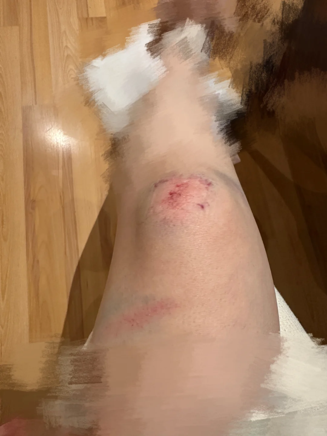 在澳洲被羊撞瘸了这正常吗?