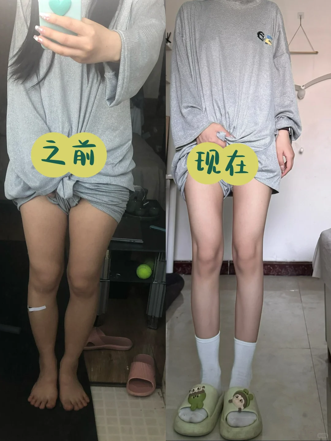 梨形身材➕脂包肌 瘦小腿干货分享（附经验）