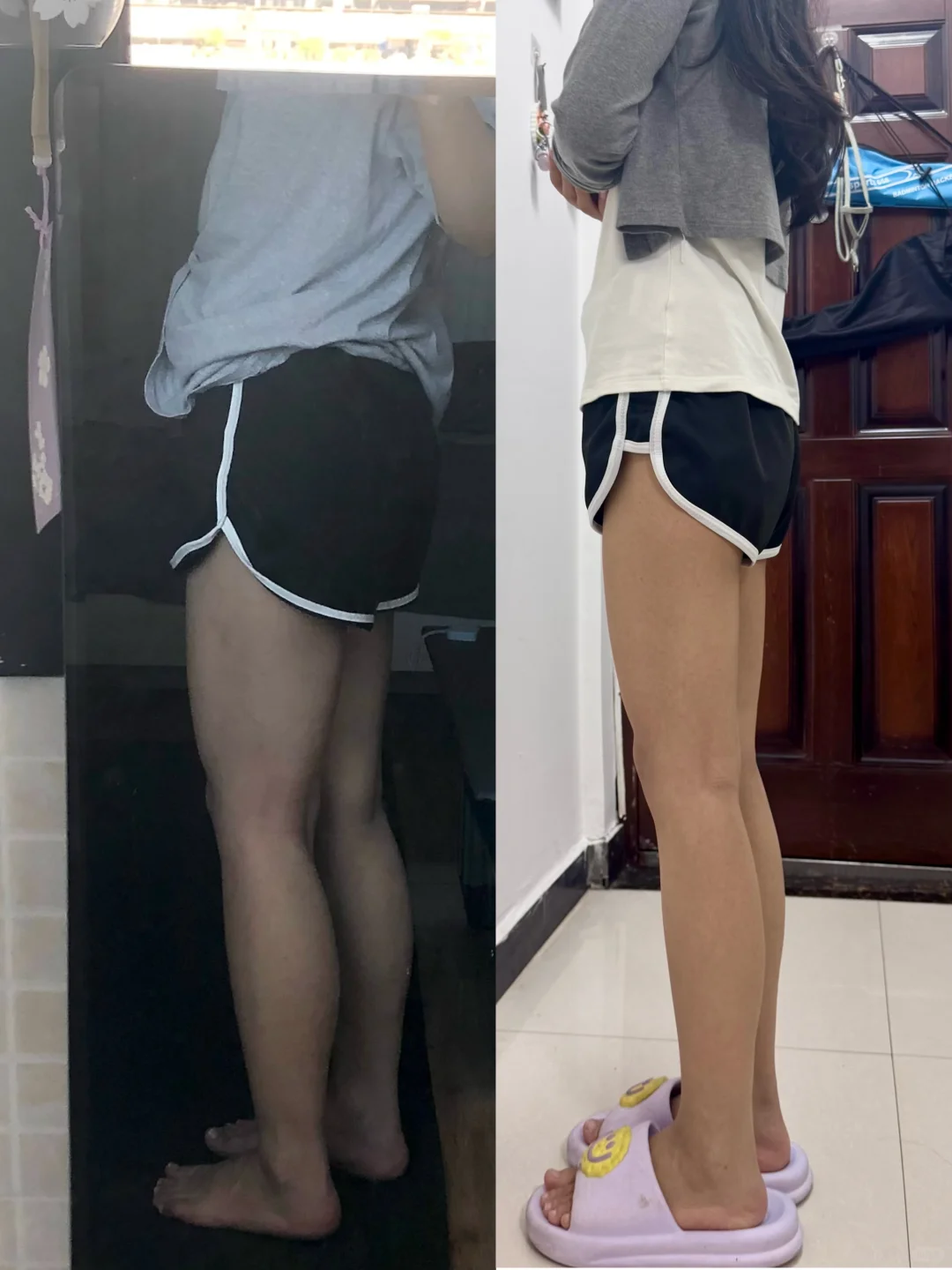 梨形身材➕脂包肌 瘦小腿干货分享（附经验）