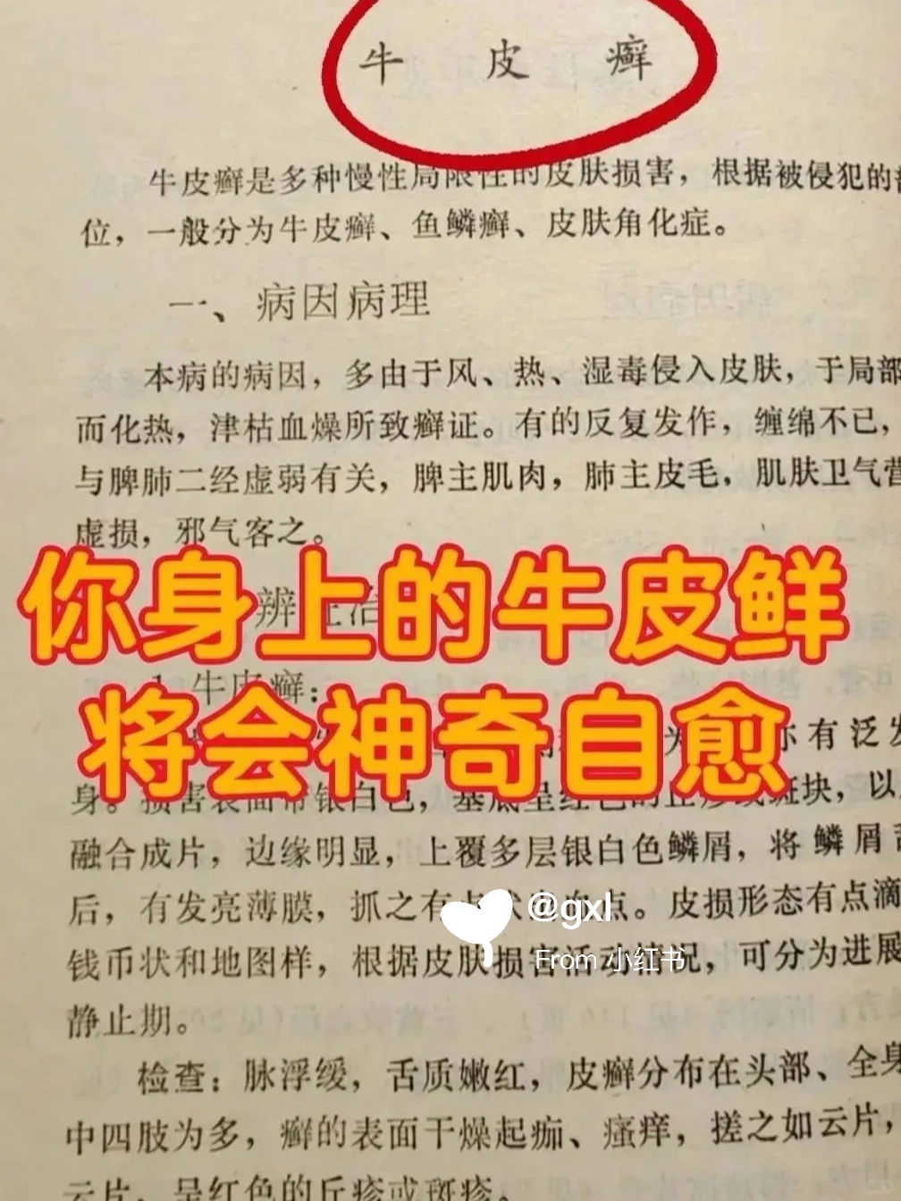老一辈留下的方子