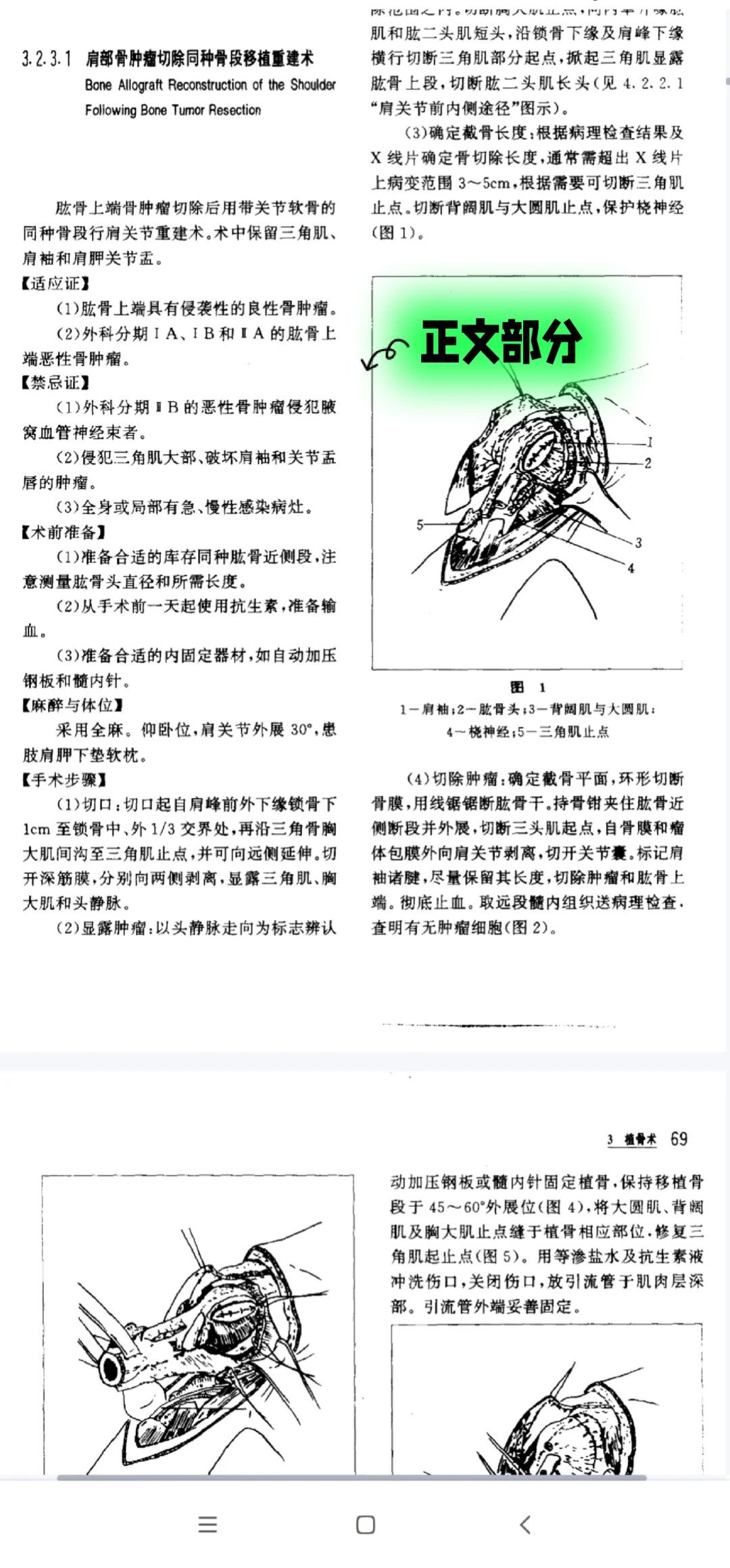 手术学全集pdf