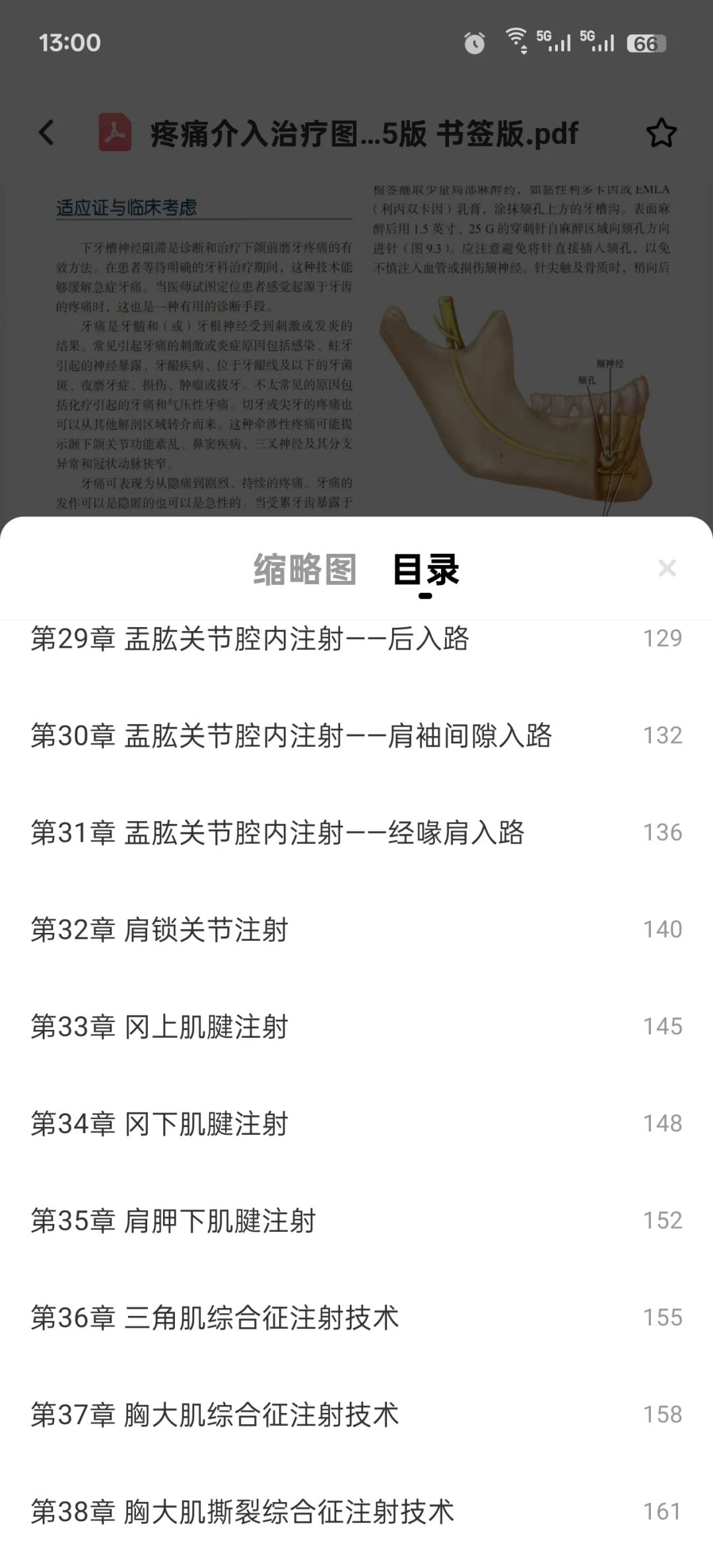 新书推荐：疼痛介入治疗图谱